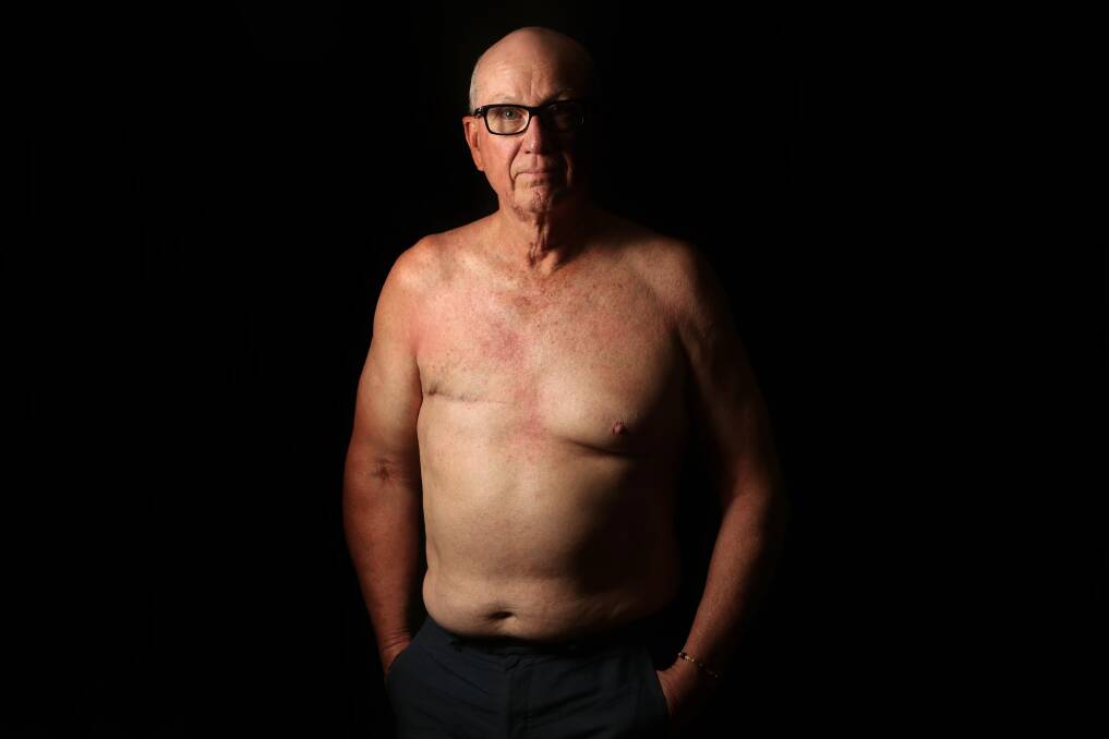 NOT JUST WOMEN: Male breast cancer advocate Rob Fincher, who has been living with metastatic breast cancer since 2014, wants to raise community awareness. Picture: Sylvia Liber